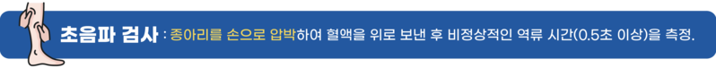 하지정맥류 자가진단