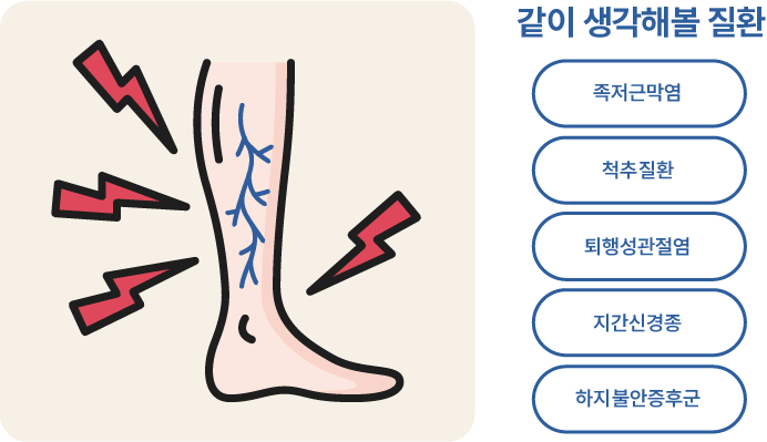 하지정맥류 자가진단